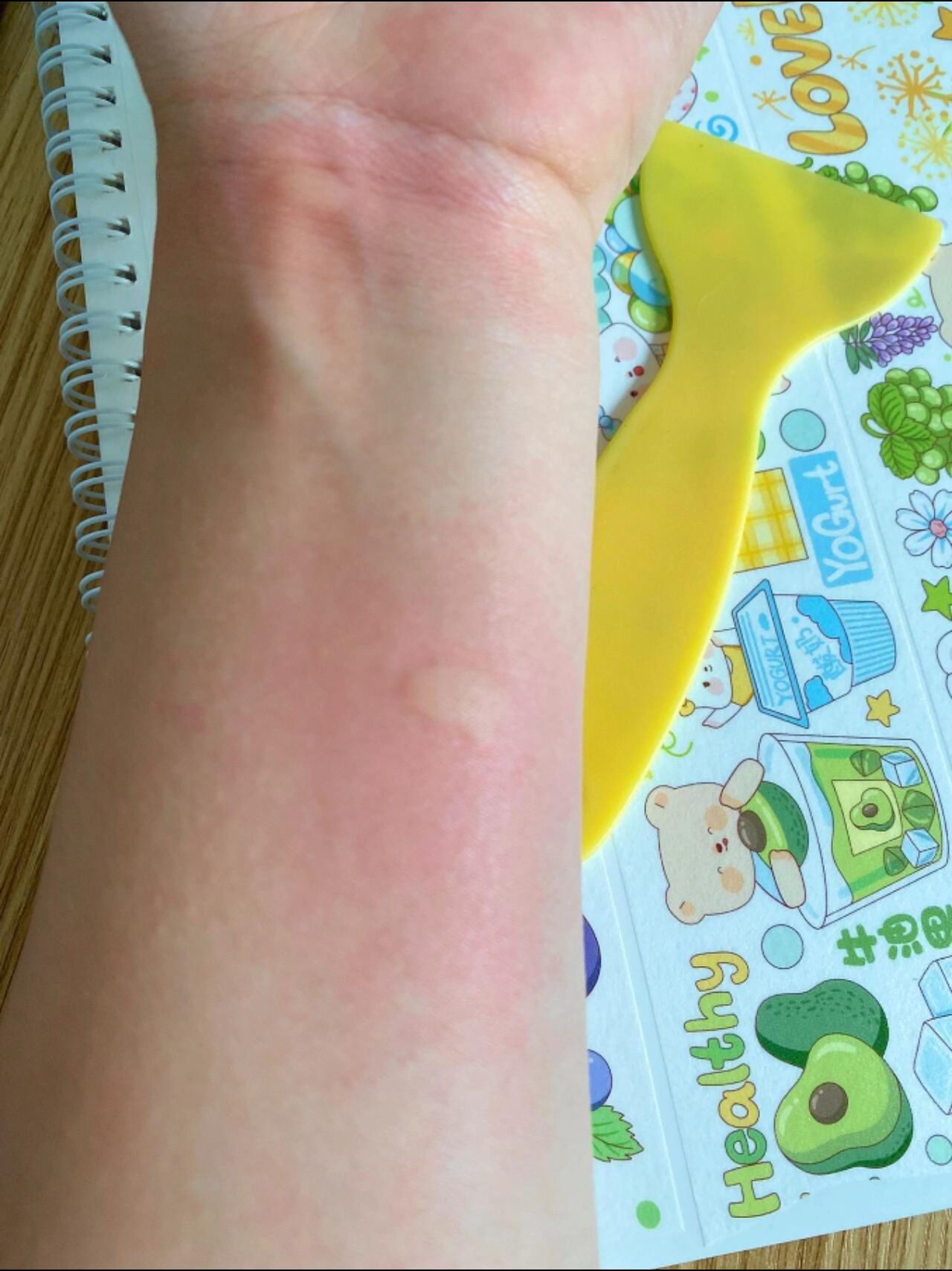 钓鱼饵料过敏图片(钓鱼饵料过敏图片大全)