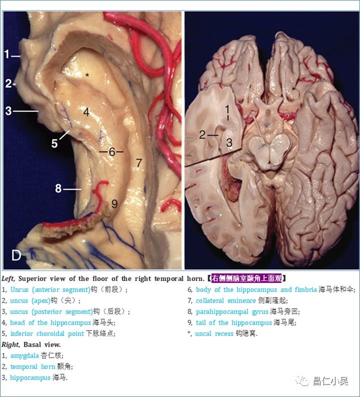 海钓乌头神经钩介绍(乌头鱼用什么饵料最好钓)