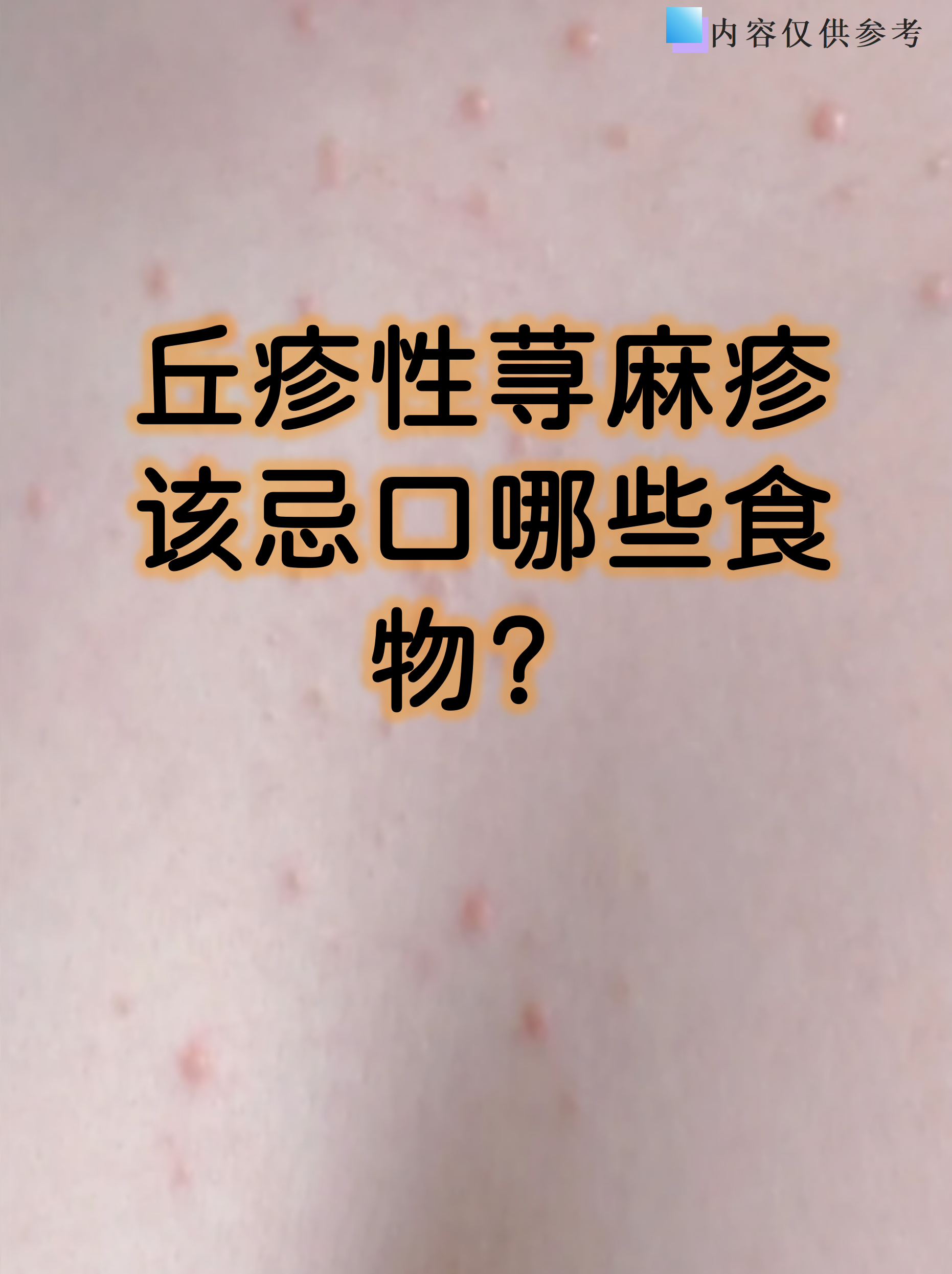 饵料为什么过敏(饵料过敏用什么药)